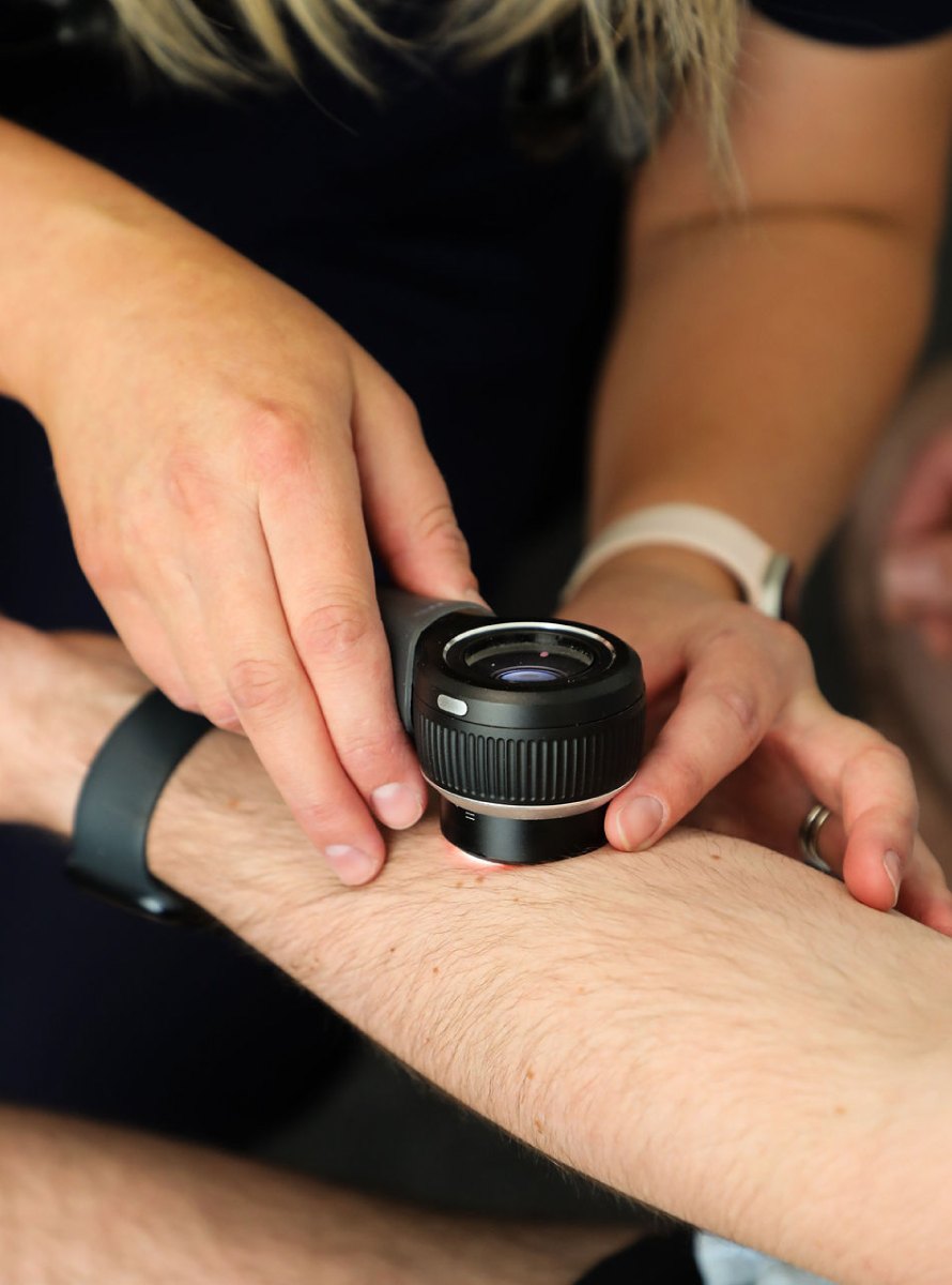 A dermatoscope pressed to a patient's forearm during a skin check